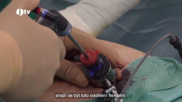 4. díl - Žlučník